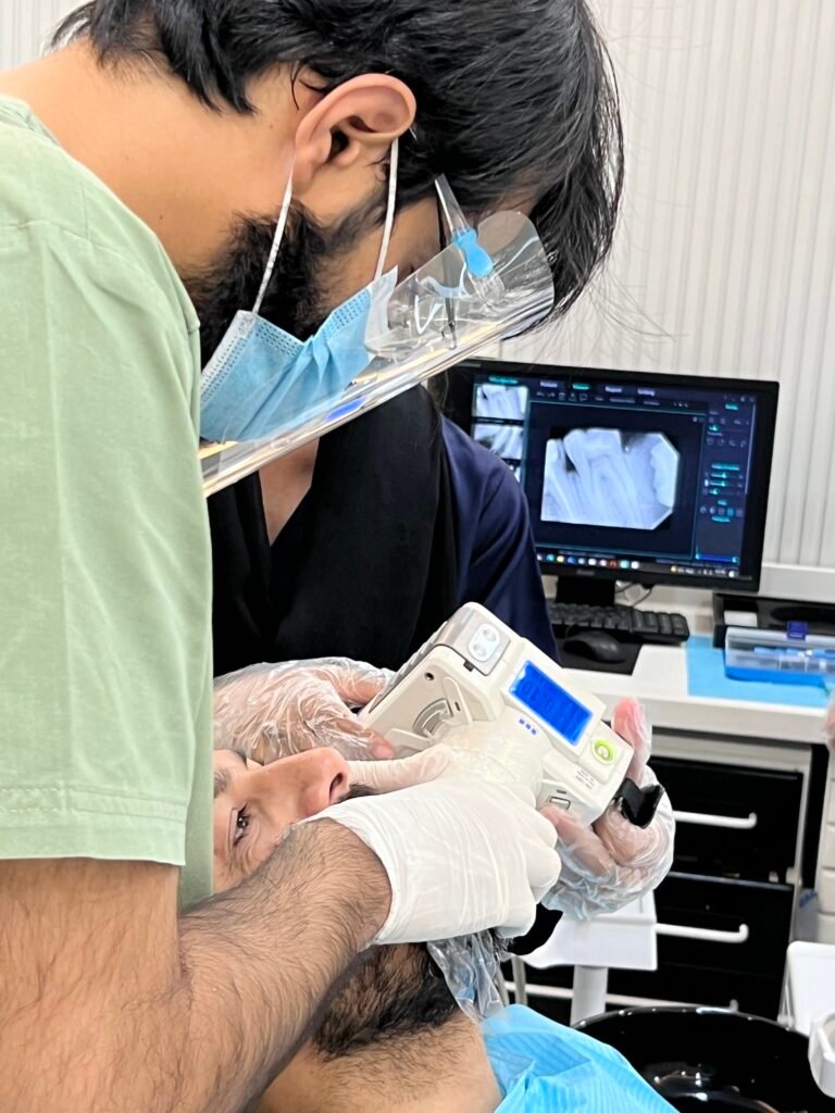 dental impant